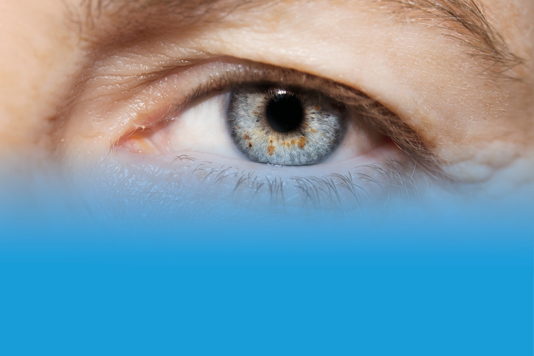 La blépharoplastie: Invitation à la conférence à Fribourg
